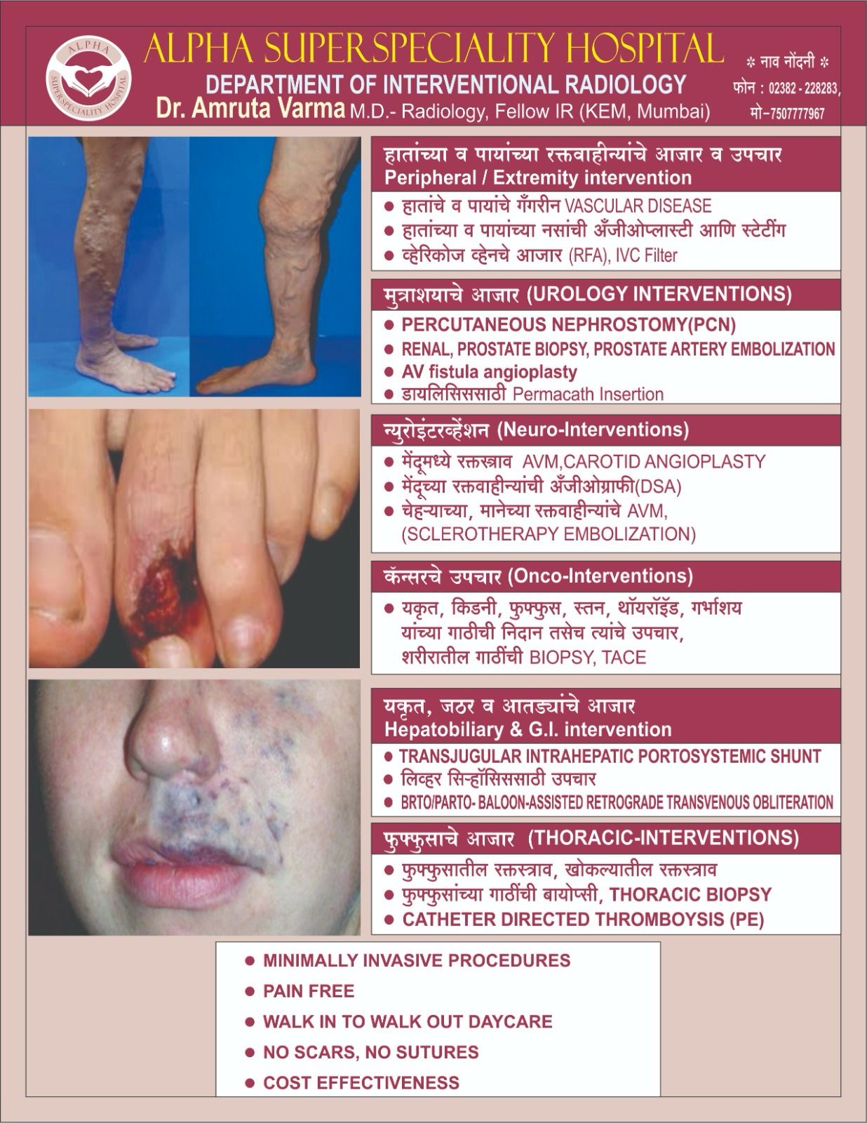 IR Services Poster